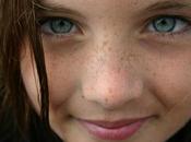 Tratamiento Manchas Solares