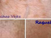 Cremhidral anti-manchas ácido kójico Laboratorios Zorgan