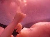 Segunda carta- vida placentera placentaria