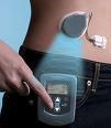 Prueban éxito pancreas aArtificial