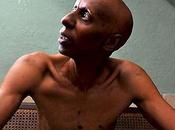 Guillermo Fariñas muere