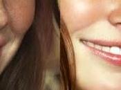 Rostro manchas