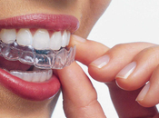 INVISALIGN, ortodoncia revolucionariamente invisible