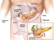 Cancer pancreas: nuevo tratamiento mejora pronÓstico