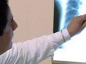 Realiza IMSS programa preventivo para combatir tuberculosis