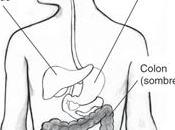 Colonoscopia