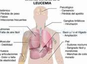 Logran frenar leucemia autoataque celulas sanas