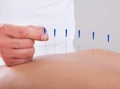 acupuntura buena para enfermedades inflamatorias