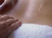 está demostrado acupuntura elimine náuseas durante embarazo