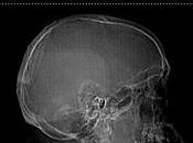 Complicaciones abuso drogas alcohol