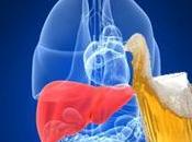Cómo alcohol afecta hígado