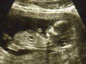 quiero hijo subnormal