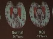 Curso para familiares cuidadores pacientes Alzheimer