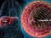 Sanidad financia cura hepatitis precio inasumible”
