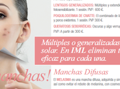 ¡Horror: tengo manchas!