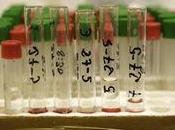 alteración genética asociada infertilidad masculina