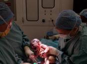 cesárea aumenta ligeramente riesgo segundo embarazo problemas