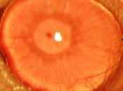 Logran regeneración completa corneas