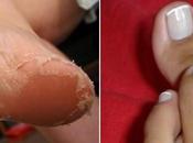 Prepara casa exfoliante para pies.