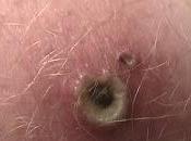 Soñar interpretación. ¿Qué dice subconsciente sueños pus?