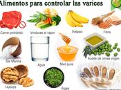 VARICES: Como prevenirlas?