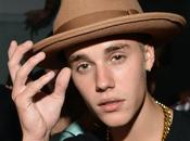 Justin Bieber Acusado Asalto Conducción Temeraria Canadá