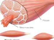 Tratamiento básico contracturas musculares