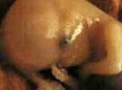 Franco battiato fetus