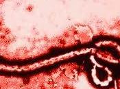 Confirma Primer Caso Ebola America