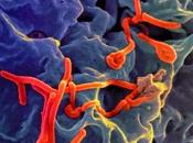 Virólogos rusos planean presentar vacunas para ébola plazo meses.