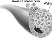 Nuevas pistas sobre cómo propaga cáncer