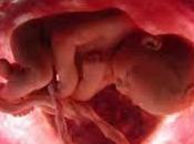 significado soñar cordón umbilical