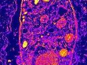 Elige bien comensal... toxoplasma gondii