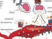 Escombroidosis