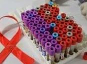 nuevo avance contra SIDA.