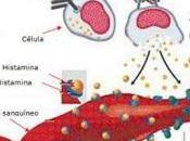 Escombroidosis