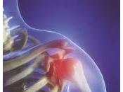 Causas dolor hombro
