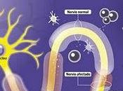 Esclerosis múltiple: primeros tratamientos forma pastillas invitan optimismo