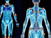 Descubierta causa real fibromialgia