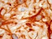 astrocitos relación neuronas