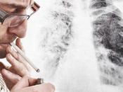 Medidas para prevenir cáncer pulmón