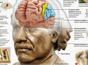 cerebro einstein