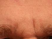 Depresión persistente incrementaría riesgo sufrir accidentes cerebrovasculares