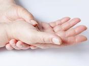 ¿Qué debe saber sobre artritis reactiva?