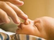 Ictericia recien nacidos