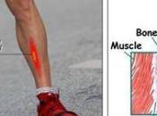 peores lesiones corredor