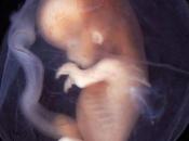 Polémica Estados Unidos presunta venta órganos fetos