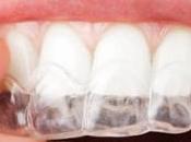 Cómo enderezar dientes aparatos