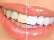 Como hacer blanqueamiento dental casero