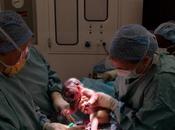 Brasil pone marcha plan para reducir elevada tasa partos cesárea